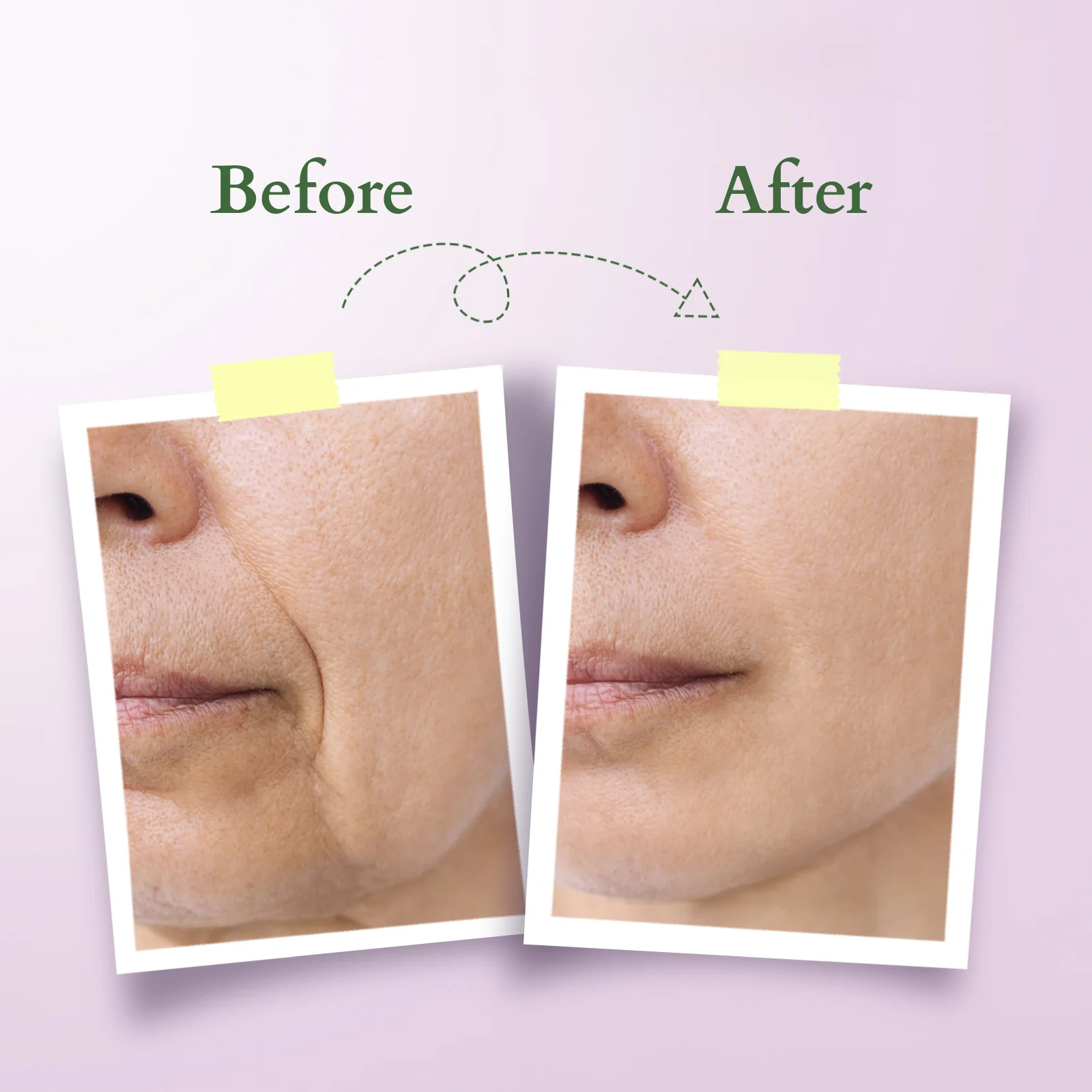 Bakuchiol Plant Retinol Oil to Foam Cleanser - Image 6