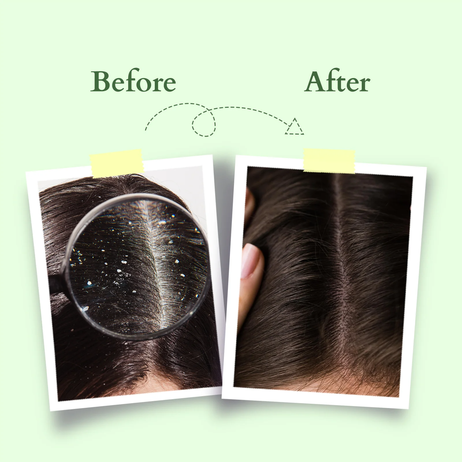 Organics+ Chemical-Free Anti-Dandruff Shampoo - Image 7