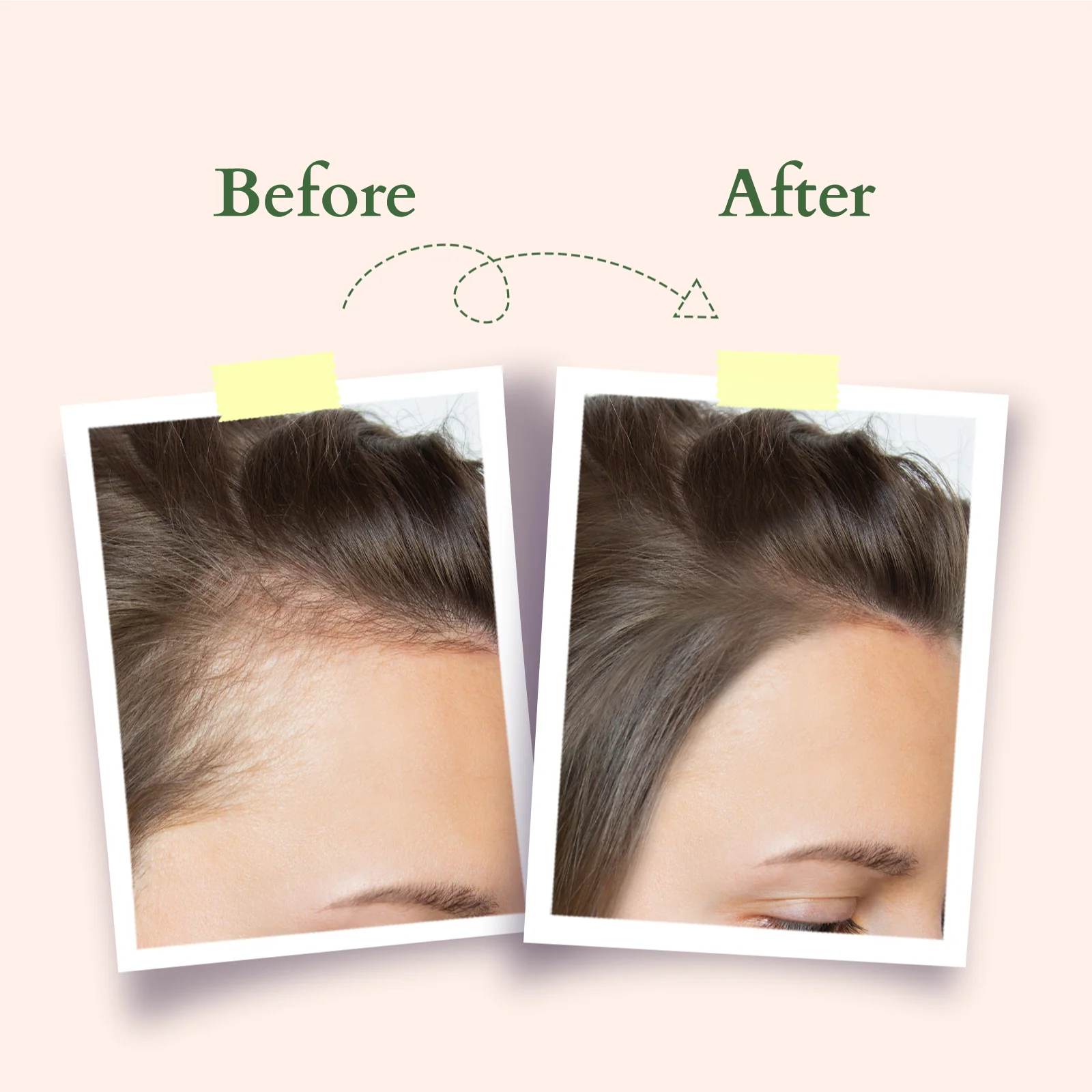 Organics+ Hair Fall Control Revitalizer - Image 7