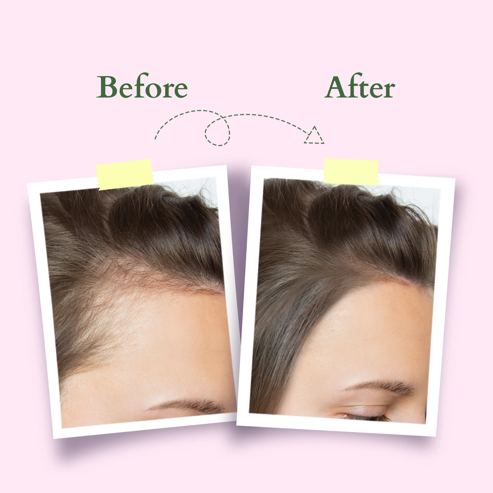 Organics+ Hair Growth Active-Concentrate Serum - Image 7