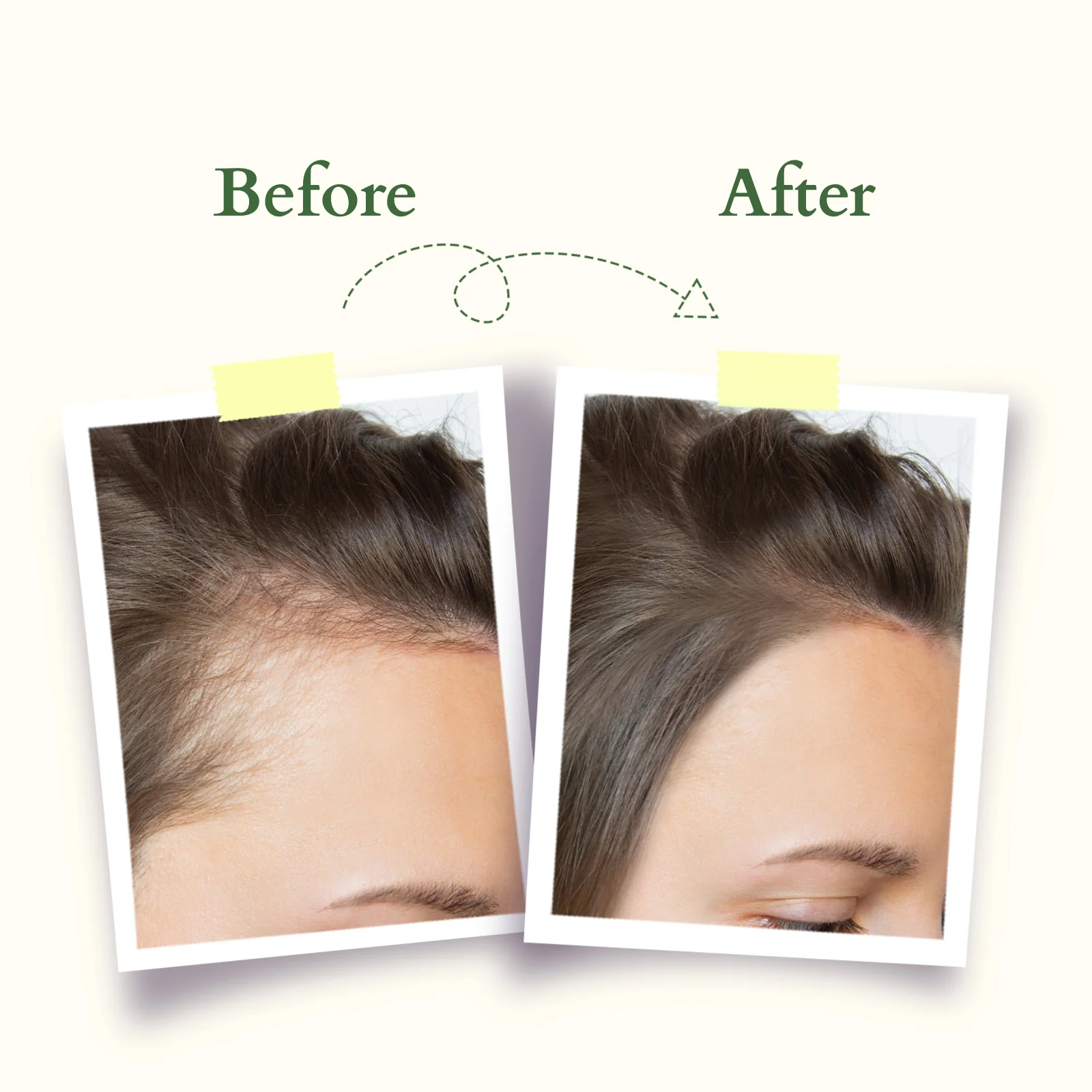 Organics+ Intensive Scalp Care Shampoo - Image 6