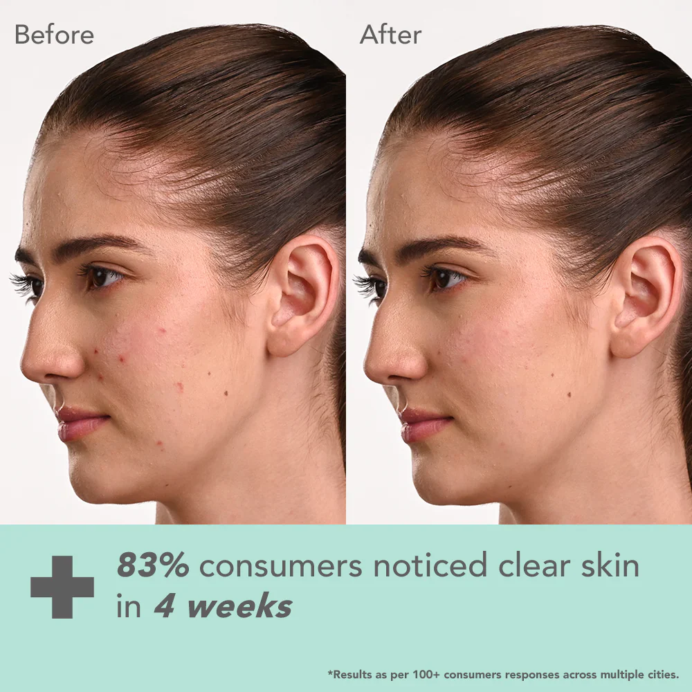 DermaBotanics Kojic acid + Multi berry Ampoule Crème - Image 3