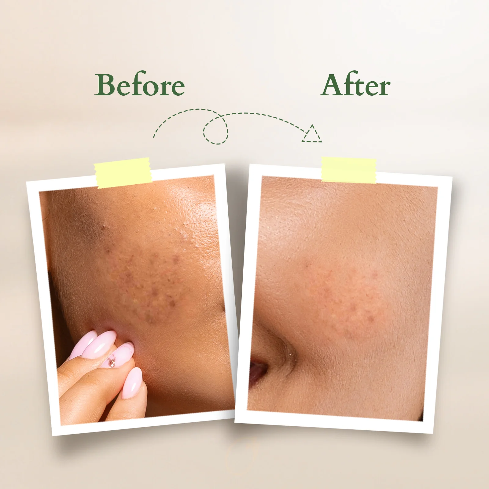 Organics+ Vitamin-C Glow Face Oil - Image 6